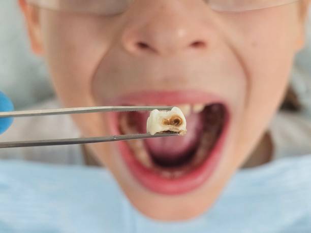 Best Dentist Open Late Near Me  in Stowell, TX